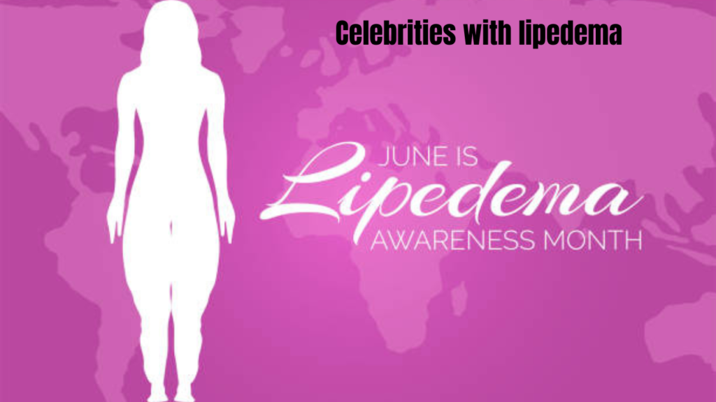 celebrities with lipedema